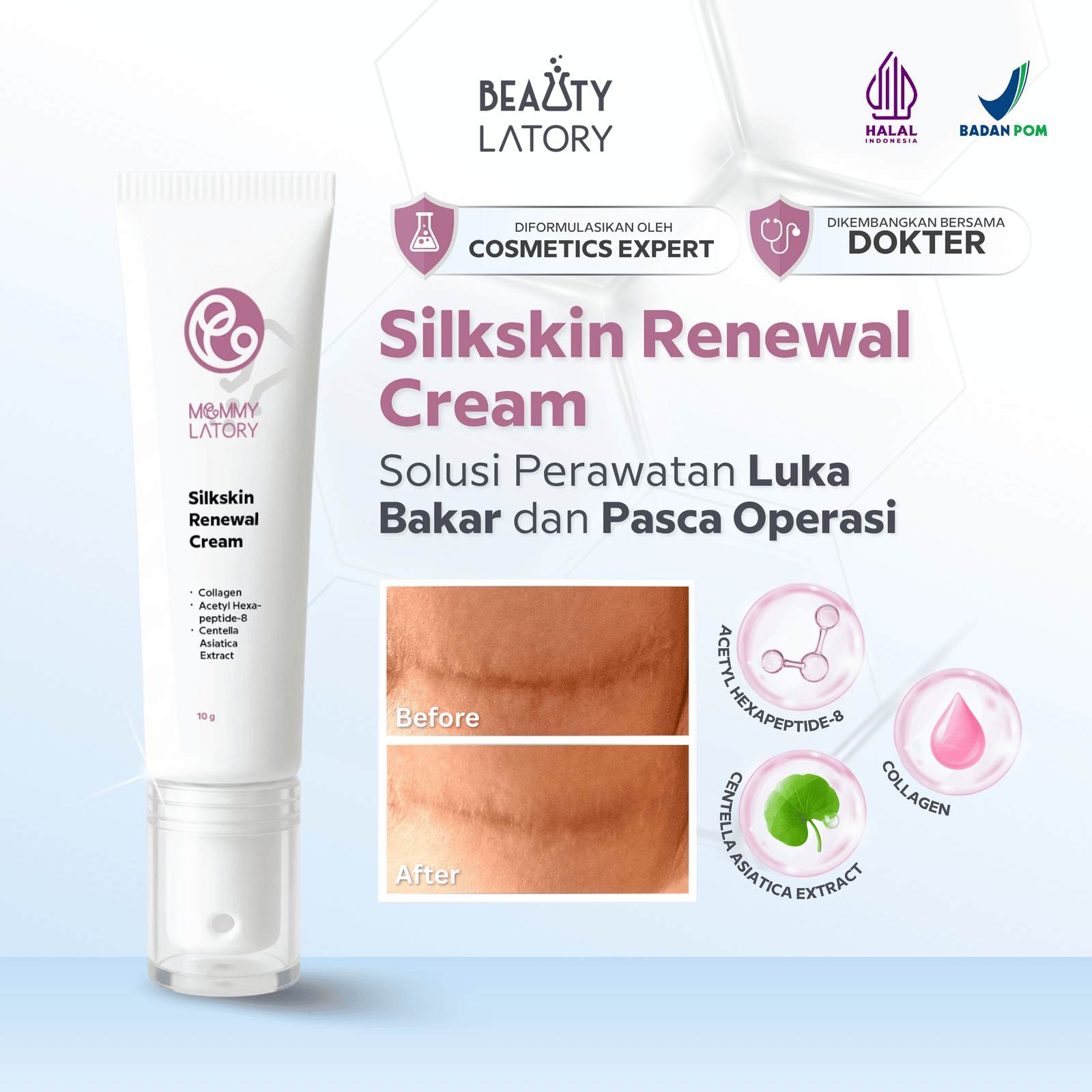 MOMMYLATORY Silk Skin Renewal Cream 10g - Krim Penghilang Bekas Luka
